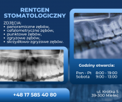 RENTGEN STOMATOLOGICZNY RENTGEN STOMATOLOGICZNY